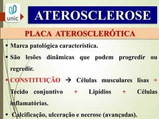 ATEROSCLEROSE
PLACA ATEROSCLERÓTICA
 Marca patológica característica.
 São lesões dinâmicas que podem progredir ou
regredir.
 CONSTITUIÇÃO  Células musculares lisas +
Tecido conjuntivo + Lipídios + Células
inflamatórias.
 Calcificação, ulceração e necrose (avançadas).
 