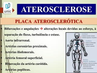 ATEROSCLEROSE
PLACA ATEROSCLERÓTICA
 Bifurcações e angulações  alterações locais devidas ao esforço, à
separação do fluxo, turbulência e estase.
 Aorta infrarrenal.
 Artérias coronárias proximais.
 Artérias iliofemorais.
 Artéria femoral superficial.
 Bifurcação da artéria carótida.
 Artérias poplíteas.
 