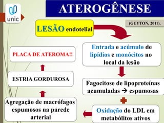 ATEROGÊNESE
LESÃO endotelial
Entrada e acúmulo de
lipídios e monócitos no
local da lesão
Fagocitose de lipoproteínas
acumuladas  espumosas
Agregação de macrófagos
espumosos na parede
arterial
ESTRIA GORDUROSA
Oxidação do LDL em
metabólitos ativos
PLACA DE ATEROMA!!
(GUYTON, 2011).
 