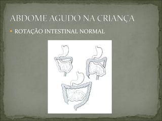 ROTAÇÃO INTESTINAL NORMAL 
