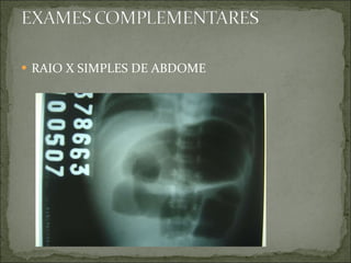 RAIO X SIMPLES DE ABDOME 