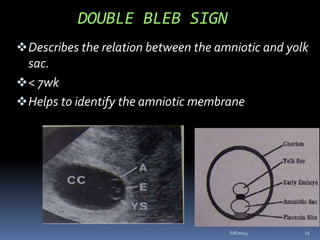 OBS US and GYN IMAGING.pptx redae malday | PPTX