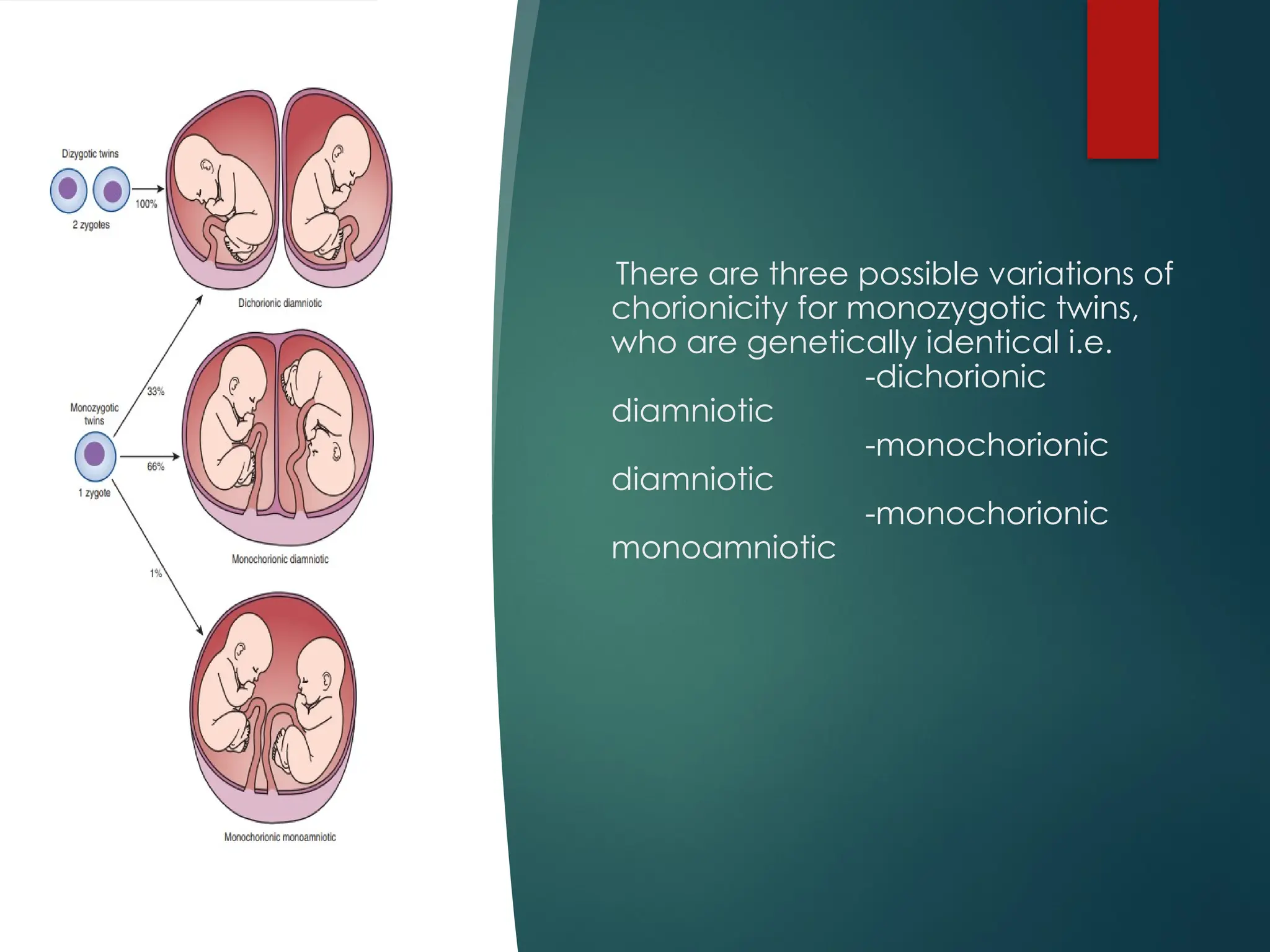 There are three possible variations of
chorionicity for monozygotic twins,
who are genetically identical i.e.
-dichorionic
diamniotic
-monochorionic
diamniotic
-monochorionic
monoamniotic
 