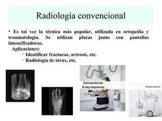 Radiología convencional 
 Es tal vez la técnica más popular, utilizada en ortopedia y 
traumatología. Se utilizan placas junto con pantallas 
intensificadoras. 
Aplicaciones: 
 Identificar fracturas, artrosis, etc. 
 Radiología de tórax, etc. 
 