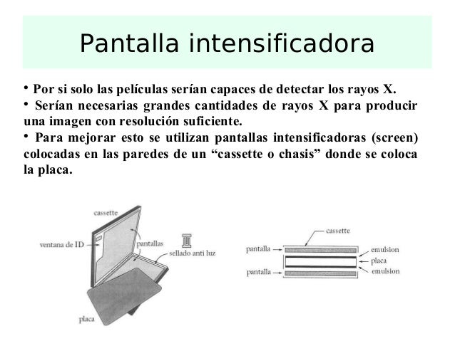 Obtencion dela imagen