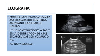 ECOGRAFIA
• PERMITE IDENTIFICAR CUALQUIER
ASA DILATADA QUE CONTENGA
ABUNDANTE CANTIDAD DE
LIQUIDO
• UTIL EN OBSTRUCCIONES ALTAS Y
EN LA IDENTIFICACION DE ASAS
ENCARCELADAS CON VOLVULO O
NO.
• RAPIDO Y SENCILLO
 