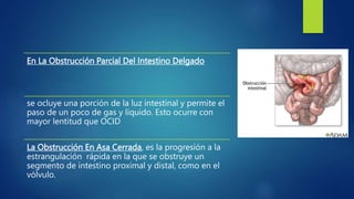 En La Obstrucción Parcial Del Intestino Delgado
se ocluye una porción de la luz intestinal y permite el
paso de un poco de gas y líquido. Esto ocurre con
mayor lentitud que OCID
La Obstrucción En Asa Cerrada, es la progresión a la
estrangulación rápida en la que se obstruye un
segmento de intestino proximal y distal, como en el
vólvulo.
 