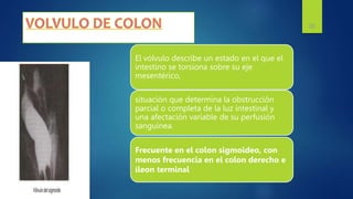 El vólvulo describe un estado en el que el
intestino se torsiona sobre su eje
mesentérico,
situación que determina la obstrucción
parcial o completa de la luz intestinal y
una afectación variable de su perfusión
sanguínea.
Frecuente en el colon sigmoideo, con
menos frecuencia en el colon derecho e
íleon terminal
35
 
