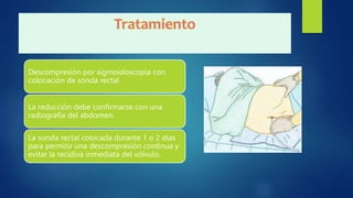 Descompresión por sigmoidoscopia con
colocación de sonda rectal
La reducción debe confirmarse con una
radiografía del abdomen.
La sonda rectal colocada durante 1 o 2 días
para permitir una descompresión continua y
evitar la recidiva inmediata del vólvulo.
 