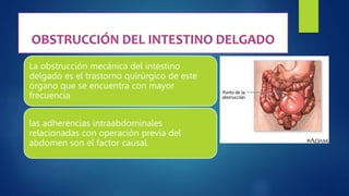 La obstrucción mecánica del intestino
delgado es el trastorno quirúrgico de este
órgano que se encuentra con mayor
frecuencia
las adherencias intraabdominales
relacionadas con operación previa del
abdomen son el factor causal.
 