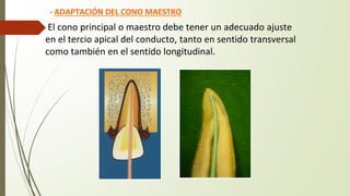 - ADAPTACIÓN DEL CONO MAESTRO
El cono principal o maestro debe tener un adecuado ajuste
en el tercio apical del conducto, tanto en sentido transversal
como también en el sentido longitudinal.
 