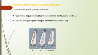 1- ADAPTACIÓN EN ANCHO DEL CONO MAESTRO
❖ Que el cono llegue a la longitud deseada pero no ajuste, queda suelto. (A)
❖ Que el cono ajuste pero no llegue a la medida establecida. (B)
Dificultades que se pueden presentar:
A B Correcta
 