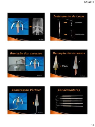 5/14/2010




                           Condensador



RX


                           Condutor de calor



      Ana Araújo




                   + 2mm


 Ana Araújo                         Ana Araújo




     Ana Araújo




                                                  10
 