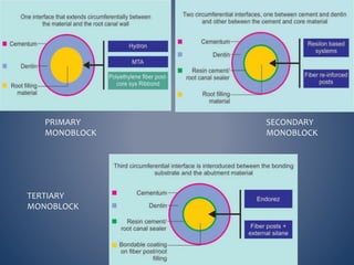 PRIMARY
MONOBLOCK
SECONDARY
MONOBLOCK
TERTIARY
MONOBLOCK
 