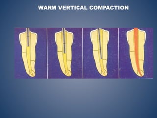 WARM VERTICAL COMPACTION
 