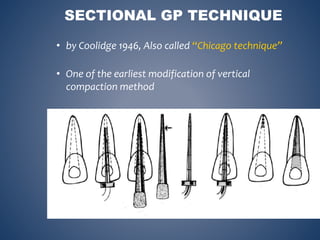 SECTIONAL GP TECHNIQUE
• by Coolidge 1946, Also called “Chicago technique”
• One of the earliest modification of vertical
compaction method
 
