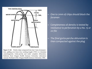 – One to 2mm of chips should block the
foramen
– Completeness of density is tested by
resistance to perforation by a No. 15 or
20 file
– The final gutta-percha obturation is
then compacted against the plug
 