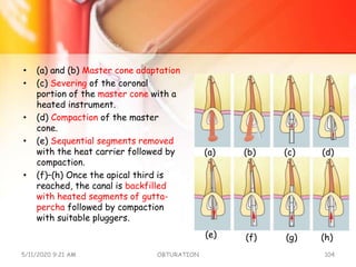 • (a) and (b) Master cone adaptation
• (c) Severing of the coronal
portion of the master cone with a
heated instrument.
• (d) Compaction of the master
cone.
• (e) Sequential segments removed
with the heat carrier followed by
compaction.
• (f)–(h) Once the apical third is
reached, the canal is backfilled
with heated segments of gutta-
percha followed by compaction
with suitable pluggers.
5/11/2020 9:21 AM OBTURATION 104
(a) (b) (c) (d)
(e) (f) (g) (h)
 