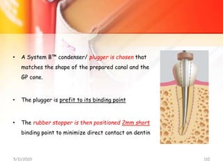 • A System B™ condenser/ plugger is chosen that
matches the shape of the prepared canal and the
GP cone.
• The plugger is prefit to its binding point
• The rubber stopper is then positioned 2mm short
binding point to minimize direct contact on dentin
5/11/2020 110
 
