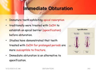 Immediate Obturation
• Immature teeth exhibiting apical resorption
• traditionally were treated with CaOH to
establish an apical barrier (apexification)
before obturation.
• Studies have demonstrated that teeth
treated with CaOH for prolonged periods are
more susceptible to fracture.
• Immediate obturation is an alternative to
apexification.
5/11/2020 9:21 AM OBTURATION 143
 