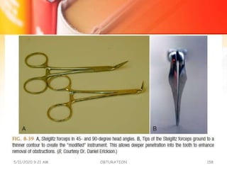 5/11/2020 9:21 AM OBTURATION 158
 