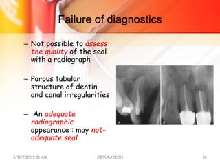 Failure of diagnostics
– Not possible to assess
the quality of the seal
with a radiograph
– Porous tubular
structure of dentin
and canal irregularities
– An adequate
radiographic
appearance : may not-
adequate seal
5/11/2020 9:21 AM OBTURATION 18
 