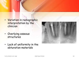 • Variation in radiographic
interpretation by the
clinician
• Overlying osseous
structures
• Lack of uniformity in the
obturation materials
5/11/2020 9:21 AM OBTURATION 19
 