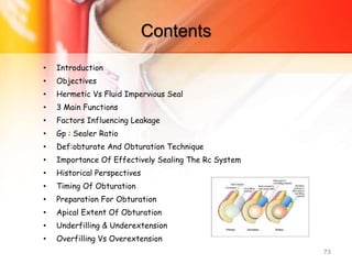 Contents
• Introduction
• Objectives
• Hermetic Vs Fluid Impervious Seal
• 3 Main Functions
• Factors Influencing Leakage
• Gp : Sealer Ratio
• Def:obturate And Obturation Technique
• Importance Of Effectively Sealing The Rc System
• Historical Perspectives
• Timing Of Obturation
• Preparation For Obturation
• Apical Extent Of Obturation
• Underfilling & Underextension
• Overfilling Vs Overextension
73
 