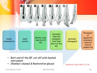 Sealer
manipulation
Canal
coated
Master cone
inserted till
WL
Spreader
inserted
alongside:
level 1mm
short of the
WL
Spreader
disengaged
Placement
of
sequential
accessory
cones by
lateral
compaction
5/11/2020 9:21 AM OBTURATION 99
Endodontic Topics 2005, 12, 2–24
• Butt end of the GP: cut off with heated
instrument
• Chamber cleaned & Restoration placed
 