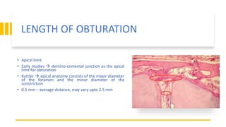 LENGTH OF OBTURATION
• Apical limit
• Early studies  dentino-cemental junction as the apical
limit for obturation
• Kuttler  apical anatomy consists of the major diameter
of the foramen and the minor diameter of the
constriction
• 0.5 mm – average distance, may vary upto 2.5 mm
 