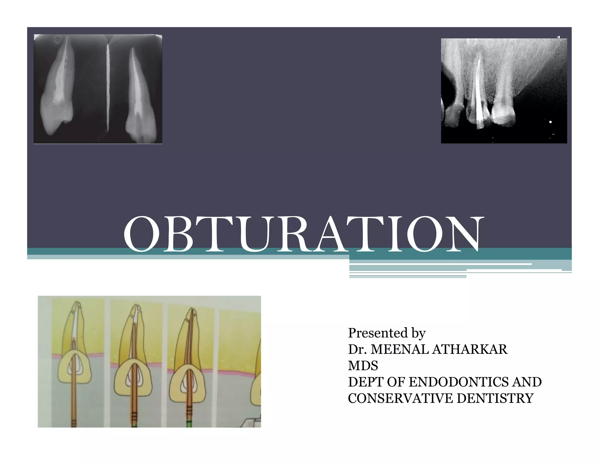Obturation PPT