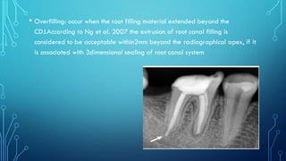 • Overfilling: occur when the root filling material extended beyond the
CDJ.According to Ng et al. 2007 the extrusion of root canal filling is
considered to be acceptable within2mm beyond the radiographical apex, if it
is associated with 3dimensional sealing of root canal system
 
