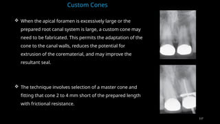 117
 When the apical foramen is excessively large or the
prepared root canal system is large, a custom cone may
need to be fabricated. This permits the adaptation of the
cone to the canal walls, reduces the potential for
extrusion of the corematerial, and may improve the
resultant seal.
 The technique involves selection of a master cone and
fitting that cone 2 to 4 mm short of the prepared length
with frictional resistance.
Custom Cones
 