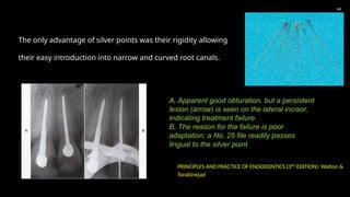 The only advantage of silver points was their rigidity allowing
their easy introduction into narrow and curved root canals.
44
A, Apparent good obturation, but a persistent
lesion (arrow) is seen on the lateral incisor,
indicating treatment failure.
B, The reason for the failure is poor
adaptation; a No. 25 file readily passes
lingual to the silver point
PRINCIPLES AND PRACTICE OF ENDODONTICS (3RD
EDITION): Walton &
Torabinejad
 