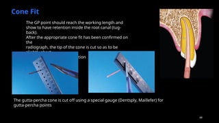 68
Phases of obturation
Cone Fit
If feathered gutta-percha cones are used, they must be
slightly shortened (Figure 22-38) up to the size of the
apical
foramen, and a radiograph taken to check the cone fit.
The gutta-percha point should reach the working
length
The GP point should reach the working length and
show to have retention inside the root canal (tug-
back).
After the appropriate cone fit has been confirmed on
the
radiograph, the tip of the cone is cut so as to be
slightly short
with respect to the preparation
The gutta-percha cone is cut off using a special gauge (Dentsply, Maillefer) for
gutta-percha points
 
