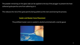 71
The powder remaining on the glass slab can be applied to the tip of the plugger to prevent the heat-
softened gutta-percha cone from adhering to it.
This reduces the risk of the gutta-percha being pulled out the root canal during the process.
Sealer and Master Cone Placement
The prefitted master cone is soaked in alcohol and dried with a sterile gauze
 