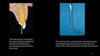 74
The heat-carrier is heating
the gutta-percha apically to
its tip and removes the
surrounding material from
the canal.
The heat-carrier is withdrawn, carrying out the
cooled gutta-percha around it. This way, the
level of the next compaction will be more apical.
 