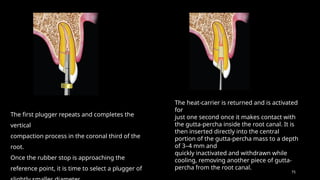 75
The first plugger repeats and completes the
vertical
compaction process in the coronal third of the
root.
Once the rubber stop is approaching the
reference point, it is time to select a plugger of
The heat-carrier is returned and is activated
for
just one second once it makes contact with
the gutta-percha inside the root canal. It is
then inserted directly into the central
portion of the gutta-percha mass to a depth
of 3–4 mm and
quickly inactivated and withdrawn while
cooling, removing another piece of gutta-
percha from the root canal.
 