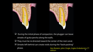 78
 During the initial phase of compaction, the plugger can leave
streaks of gutta-percha along the walls.
 They must be re-directed toward the center of the root canal.
 Streaks left behind can create voids during the “back-packing”
phase. Ilan Rostein, John I Ingle, Ingles Endodontics 7th
edition
 