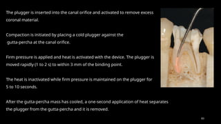 83
The plugger is inserted into the canal orifice and activated to remove excess
coronal material.
Compaction is initiated by placing a cold plugger against the
gutta-percha at the canal orifice.
Firm pressure is applied and heat is activated with the device. The plugger is
moved rapidly (1 to 2 s) to within 3 mm of the binding point.
The heat is inactivated while firm pressure is maintained on the plugger for
5 to 10 seconds.
After the gutta-percha mass has cooled, a one-second application of heat separates
the plugger from the gutta-percha and it is removed.
 