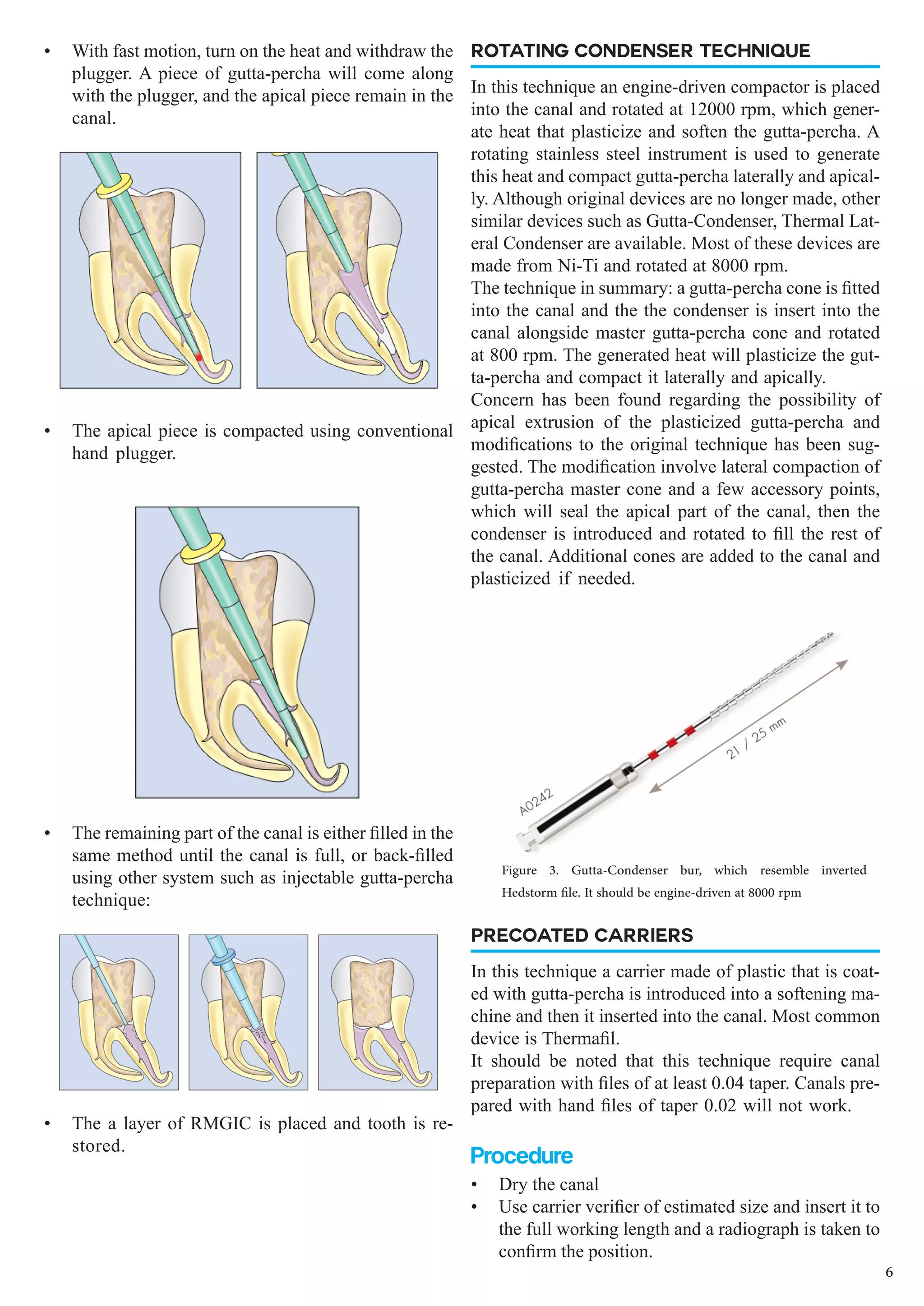 •	 With fast motion, turn on the heat and withdraw the
plugger. A piece of gutta-percha will come along
with the plugger, and the apical piece remain in the
canal.
•	 The apical piece is compacted using conventional
hand plugger.
•	 The remaining part of the canal is either filled in the
same method until the canal is full, or back-filled
using other system such as injectable gutta-percha
technique:
•	 The a layer of RMGIC is placed and tooth is re-
stored.
ROTATING CONDENSER TECHNIQUE
In this technique an engine-driven compactor is placed
into the canal and rotated at 12000 rpm, which gener-
ate heat that plasticize and soften the gutta-percha. A
rotating stainless steel instrument is used to generate
this heat and compact gutta-percha laterally and apical-
ly. Although original devices are no longer made, other
similar devices such as Gutta-Condenser, Thermal Lat-
eral Condenser are available. Most of these devices are
made from Ni-Ti and rotated at 8000 rpm.
The technique in summary: a gutta-percha cone is fitted
into the canal and the the condenser is insert into the
canal alongside master gutta-percha cone and rotated
at 800 rpm. The generated heat will plasticize the gut-
ta-percha and compact it laterally and apically.
Concern has been found regarding the possibility of
apical extrusion of the plasticized gutta-percha and
modifications to the original technique has been sug-
gested. The modification involve lateral compaction of
gutta-percha master cone and a few accessory points,
which will seal the apical part of the canal, then the
condenser is introduced and rotated to fill the rest of
the canal. Additional cones are added to the canal and
plasticized if needed.
PRECOATED CARRIERS
In this technique a carrier made of plastic that is coat-
ed with gutta-percha is introduced into a softening ma-
chine and then it inserted into the canal. Most common
device is Thermafil.
It should be noted that this technique require canal
preparation with files of at least 0.04 taper. Canals pre-
pared with hand files of taper 0.02 will not work.
Procedure
•	 Dry the canal
•	 Use carrier verifier of estimated size and insert it to
the full working length and a radiograph is taken to
confirm the position.
Figure 3. Gutta-Condenser bur, which resemble inverted
Hedstorm file. It should be engine-driven at 8000 rpm
6
 