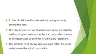 Obturation of root canals endodontics.pptx