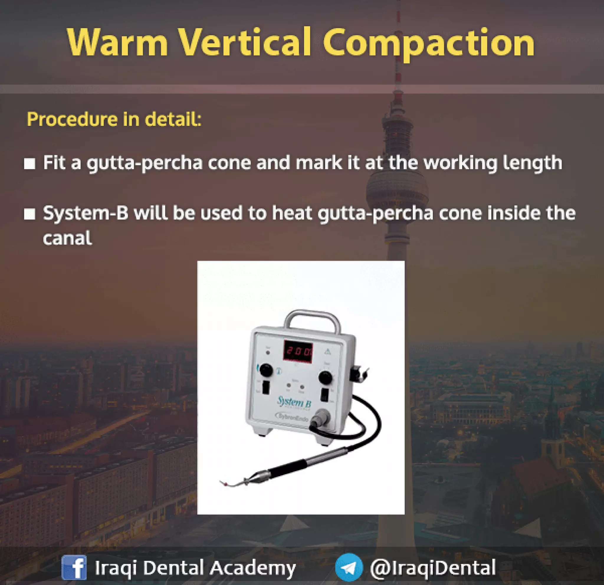 Obturation of Root Canal - Brief Presentation