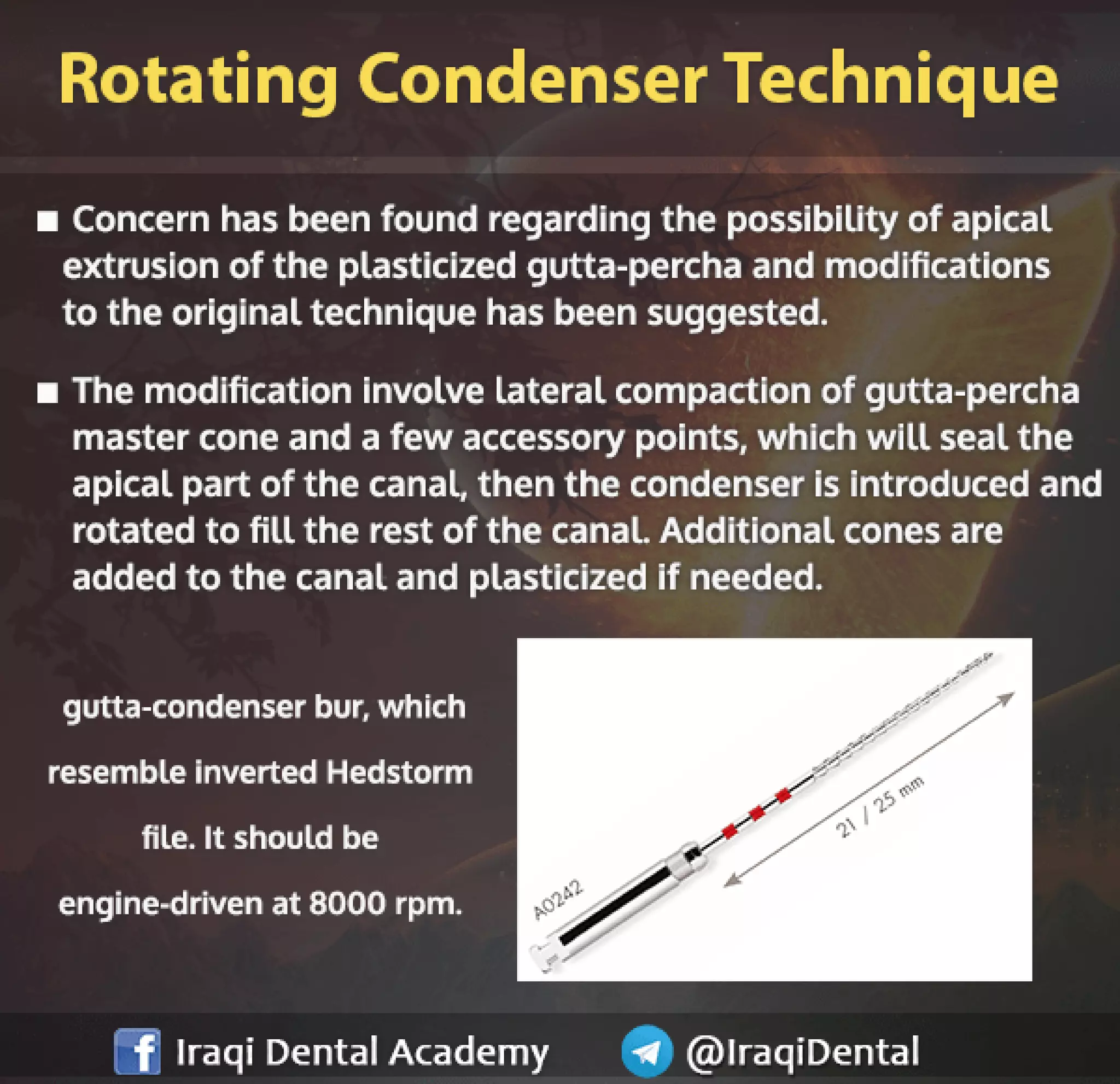 Obturation of Root Canal - Brief Presentation