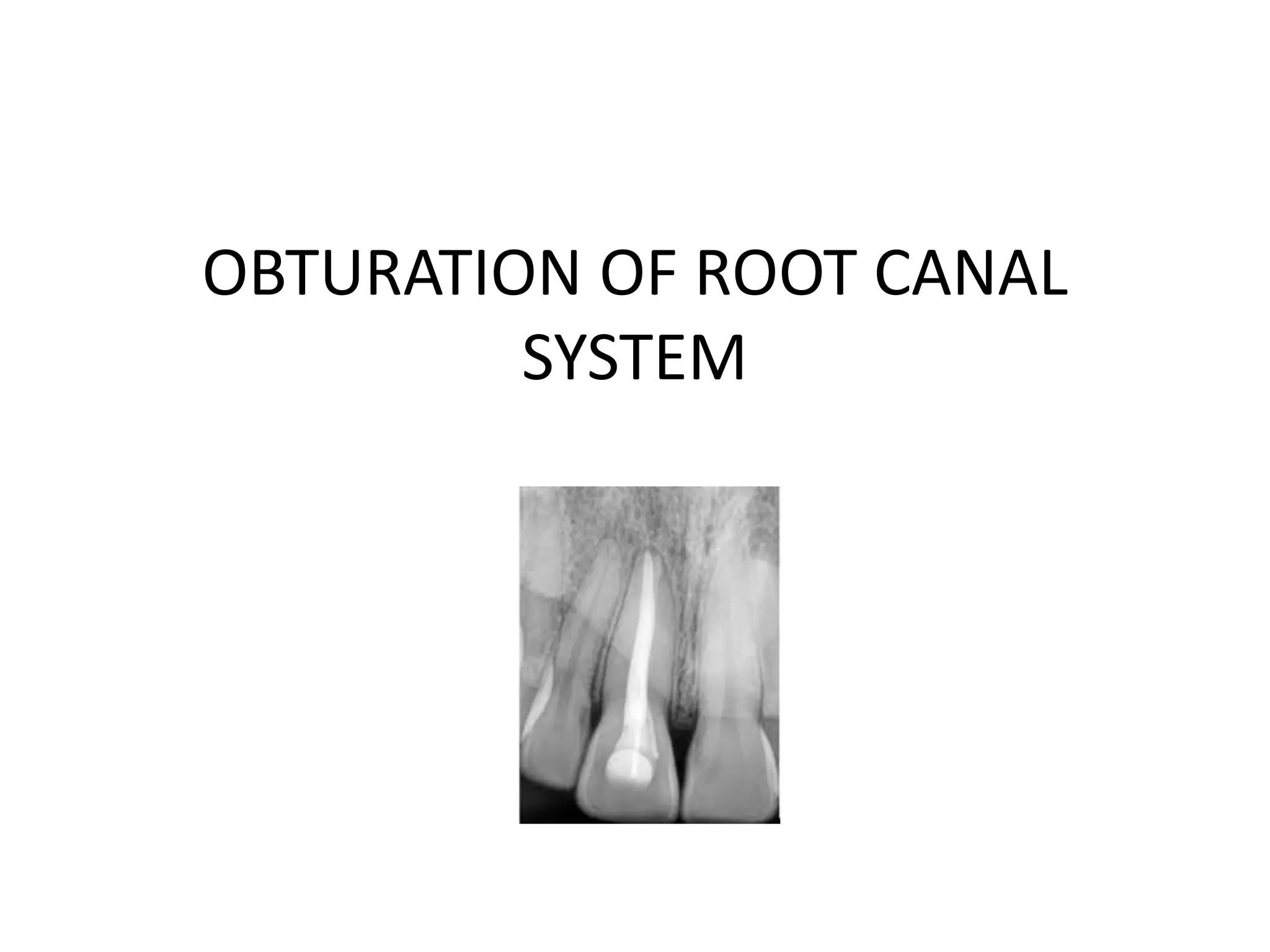 Obturation of root canal system PPT