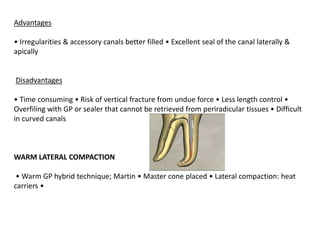 Obturation of root canal system | PPTX