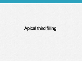 Apical third filling
 