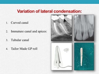 Variation of lateral condensation:
1. Curved canal
2. Immature canal and apices:
3. Tubular canal
4. Tailor Made GP roll
 