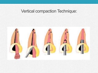 Vertical compaction Technique:
 