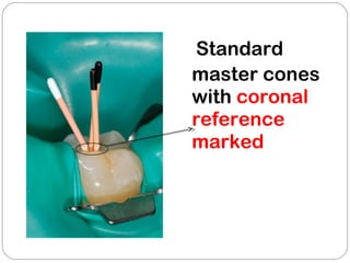 Standard
master cones
with coronal
reference
marked
 